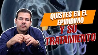 Quistes en los TESTÍCULOS y su tratamiento [upl. by Adiaroz]