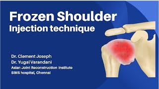 frozen shoulder injection technique [upl. by Kristy]