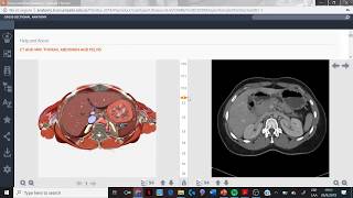 TAC de abdomen Identificando estructuras 2 [upl. by Yahsat495]