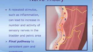 Understanding Interstitial Cystitis ICPainful Bladder Syndrome PBS [upl. by Ginder]